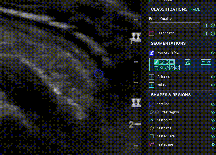 _images/CircleUse.gif
