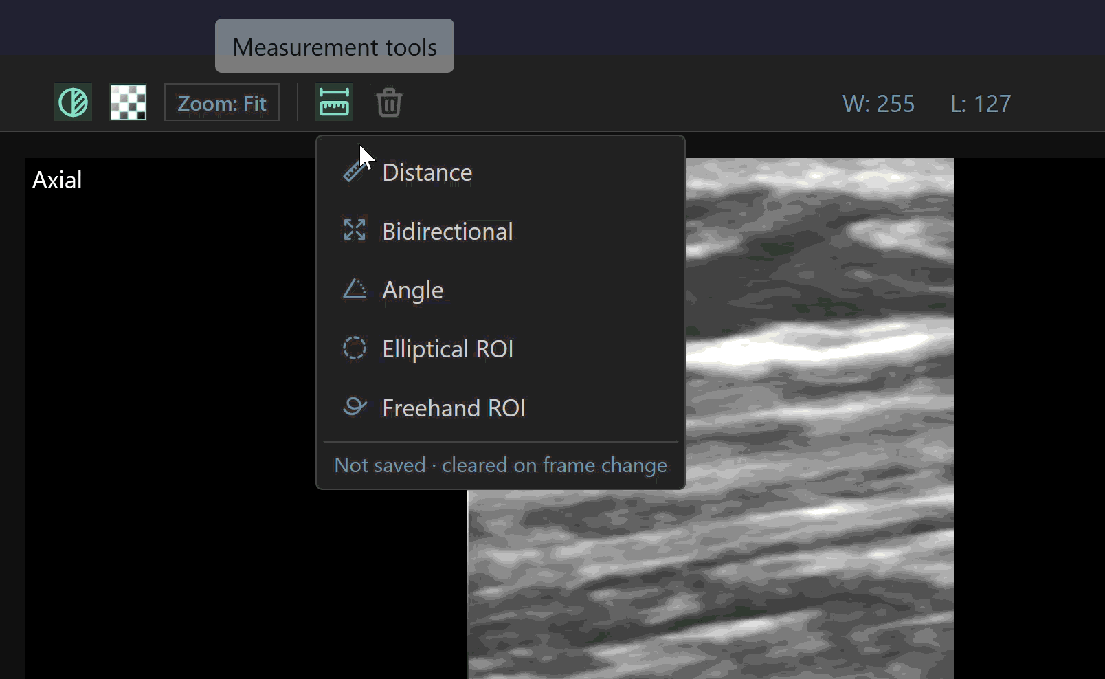 _images/DistanceUse.gif