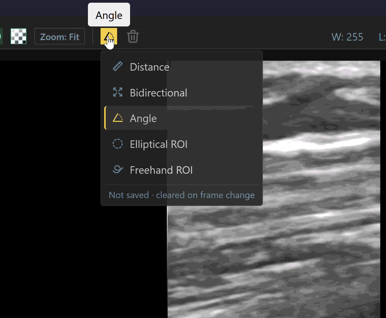 _images/EllipticalROIUse.gif