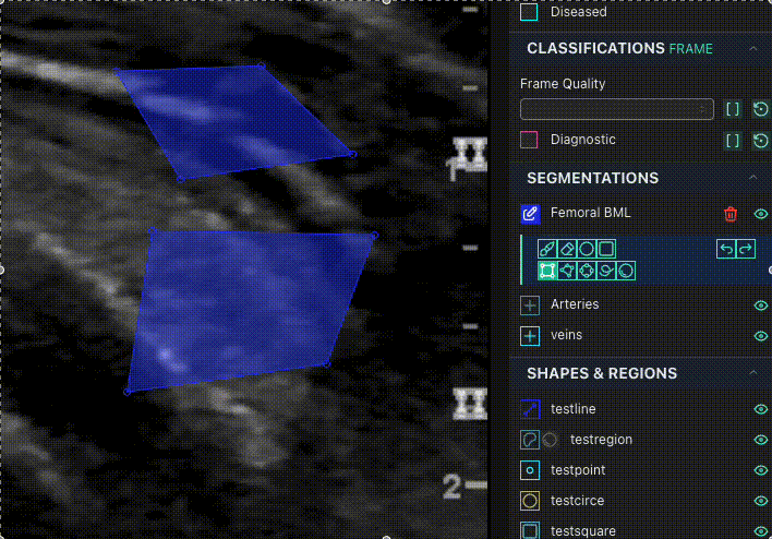 _images/SplineMerging.gif